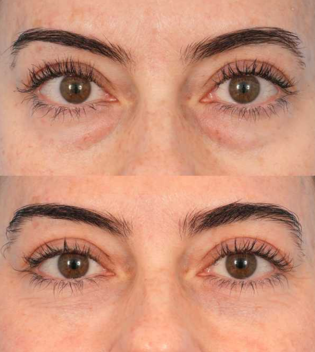 Gel Reafirmante Instantáneo