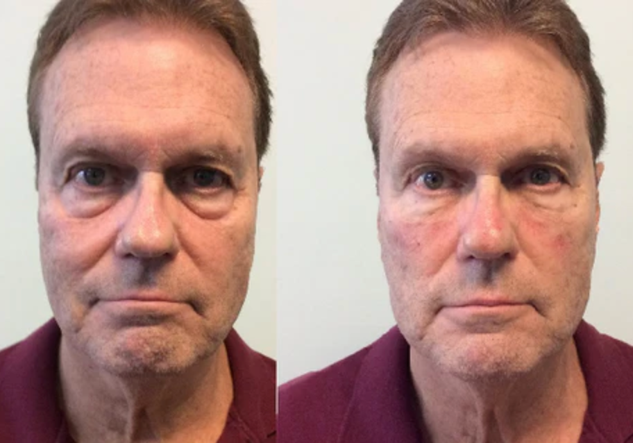 Gel Reafirmante Instantáneo