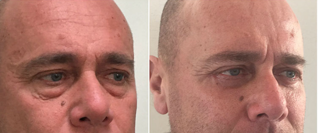 Gel Reafirmante Instantáneo