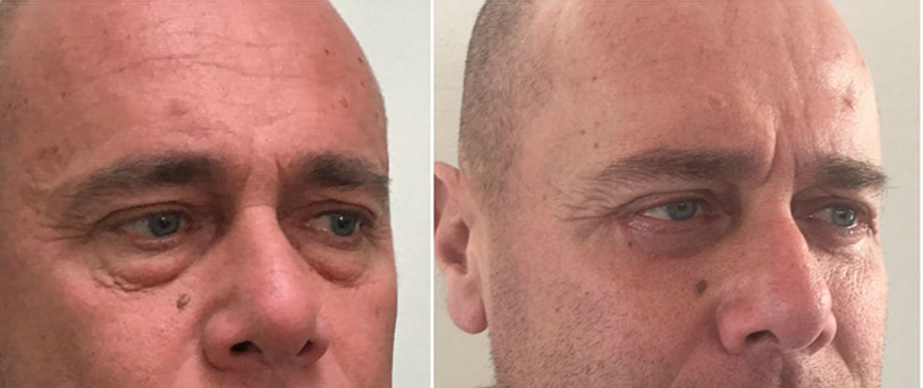 Gel Reafirmante Instantáneo